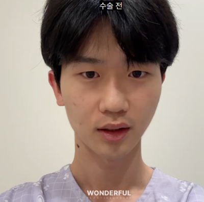 "쌍꺼풀 수술상담에서 원장님이 가장 많이 받는 질문 TOP5"