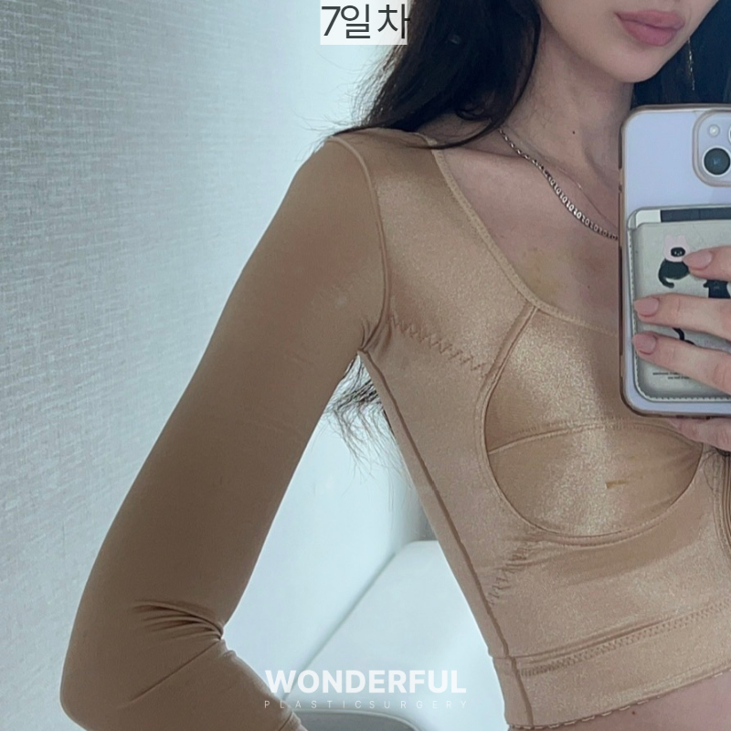 지방흡입하면 아이돌팔 다리 가능할까요?